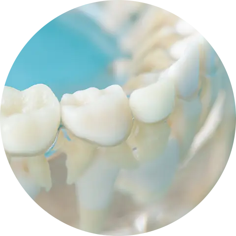 できるだけ歯を抜かない矯正